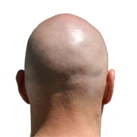 bald-head